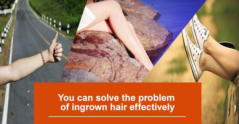 You can solve the problem of ingrown hair effectively
